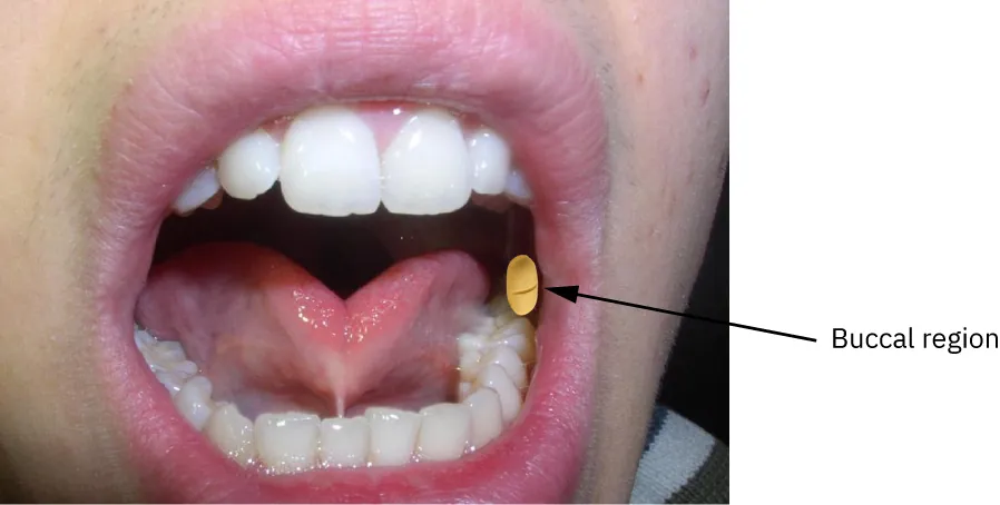 Buccal region