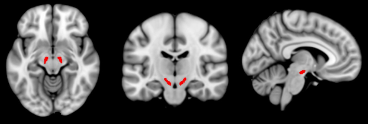 Substantia Nigra