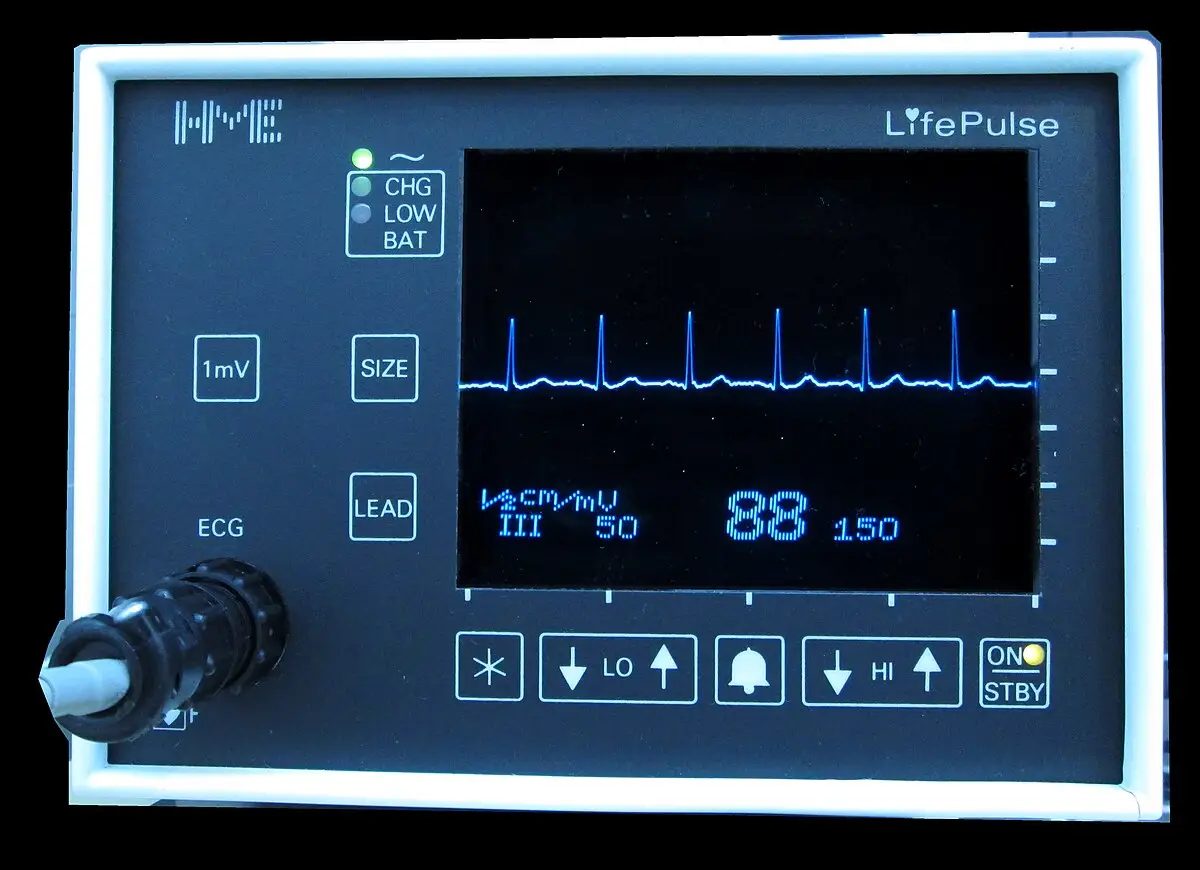 Electrocardiogram (EKG) machine used to record heart activity