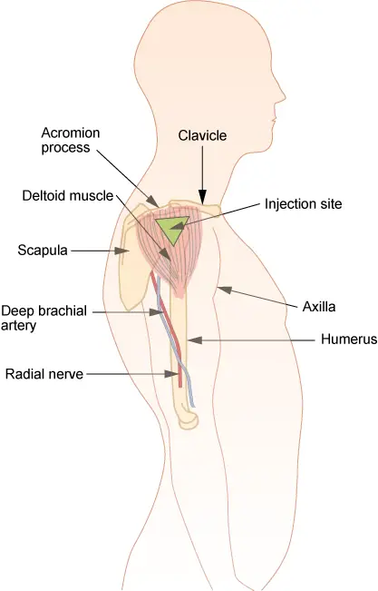 Common intramuscular and subcutaneous injection sites labeled