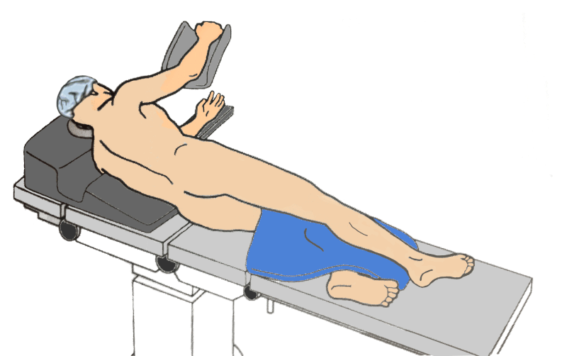 Patient positioned in left lateral recumbent position
