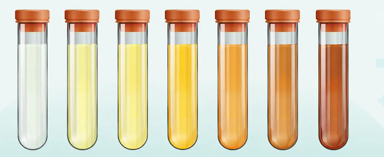 Range of urine color variations and clinical significance shown