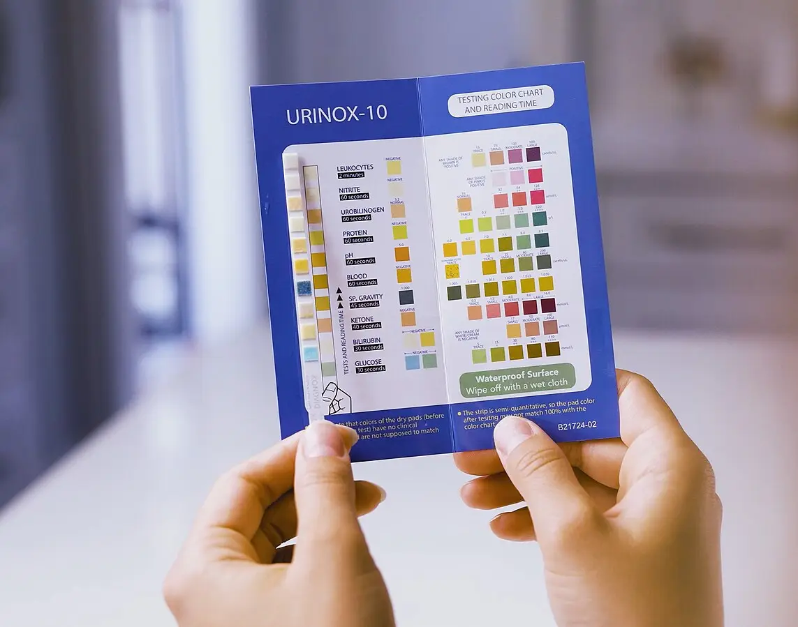 Urine reagent dipstick used for urinalysis