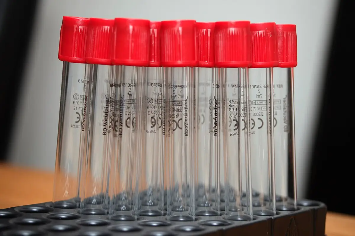Color-coded vacutainer tubes used in blood collection