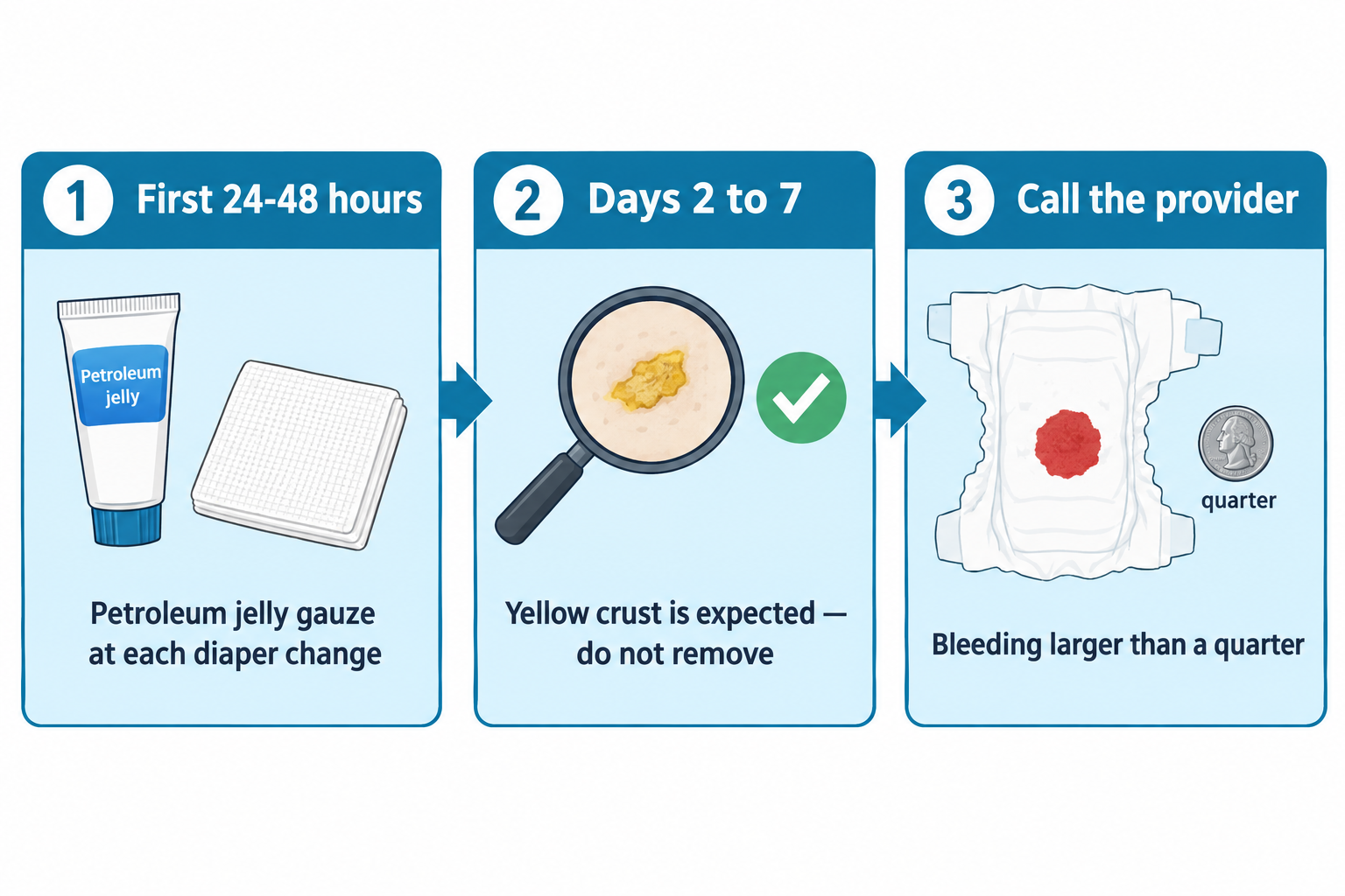Three-panel sequence for circumcision care: first, a tube of petroleum jelly and folded gauze representing petroleum jelly gauze applied at each diaper change during the first 24-48 hours; second, a magnified view of yellow crust on the healing site with a green checkmark indicating this is expected and should not be removed during days 2 to 7; third, a diaper with a red circular stain compared in size to a quarter coin, indicating the provider should be called if bleeding is larger than a quarter.