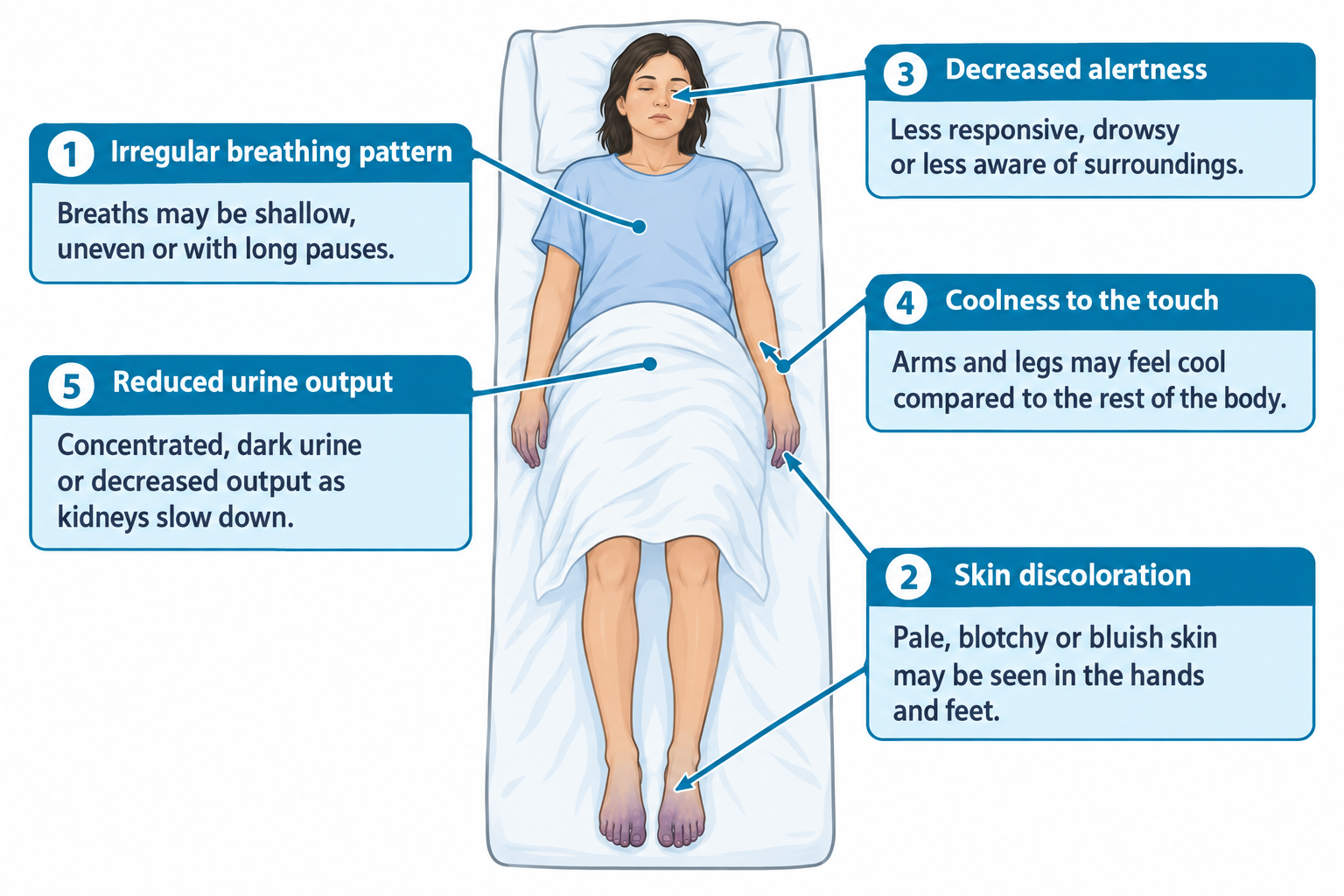 An elderly woman lies in a hospital bed under a white blanket, eyes closed, with five callout boxes pointing to different parts of her body. Labels indicate: irregular breathing pattern with shallow, uneven breaths or long pauses (pointing to the chest); skin discoloration showing pale, blotchy, or bluish skin at the hands and feet (pointing to the feet, which appear mottled purple-blue at the toes); decreased alertness showing reduced responsiveness (pointing to the closed eyes); coolness to the touch in the arms and legs (pointing to the hand); and reduced urine output as kidneys slow down (pointing to the lower torso/bladder area).