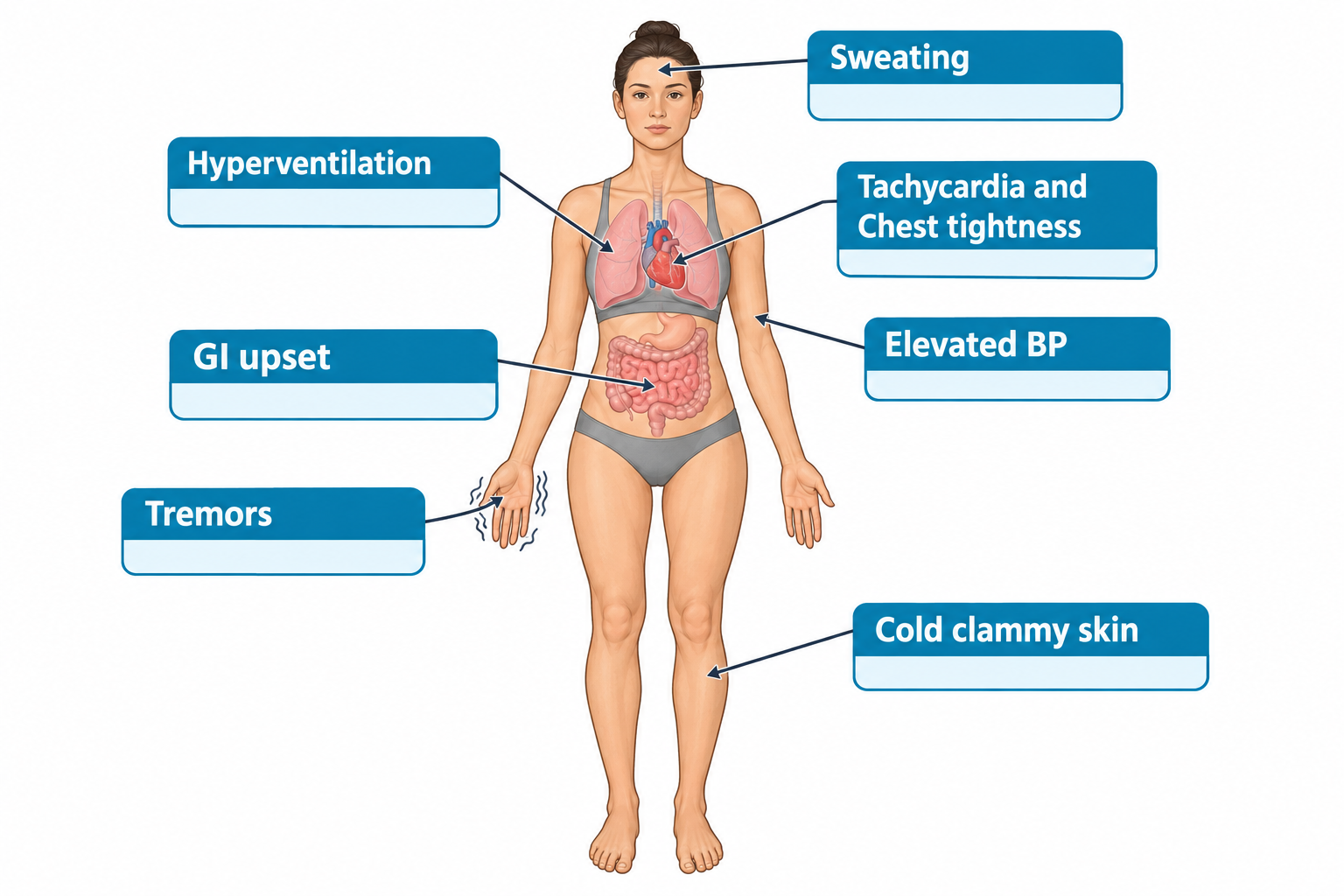 A frontal illustration of a woman's body with internal organs (lungs, heart, intestines) visible, surrounded by labeled callouts pointing to different body regions: Sweating (head), Hyperventilation (lungs), Tachycardia and Chest tightness (heart), Elevated BP (arm), GI upset (intestines), Tremors (shaking hand), and Cold clammy skin (leg), depicting physiological signs of anxiety.