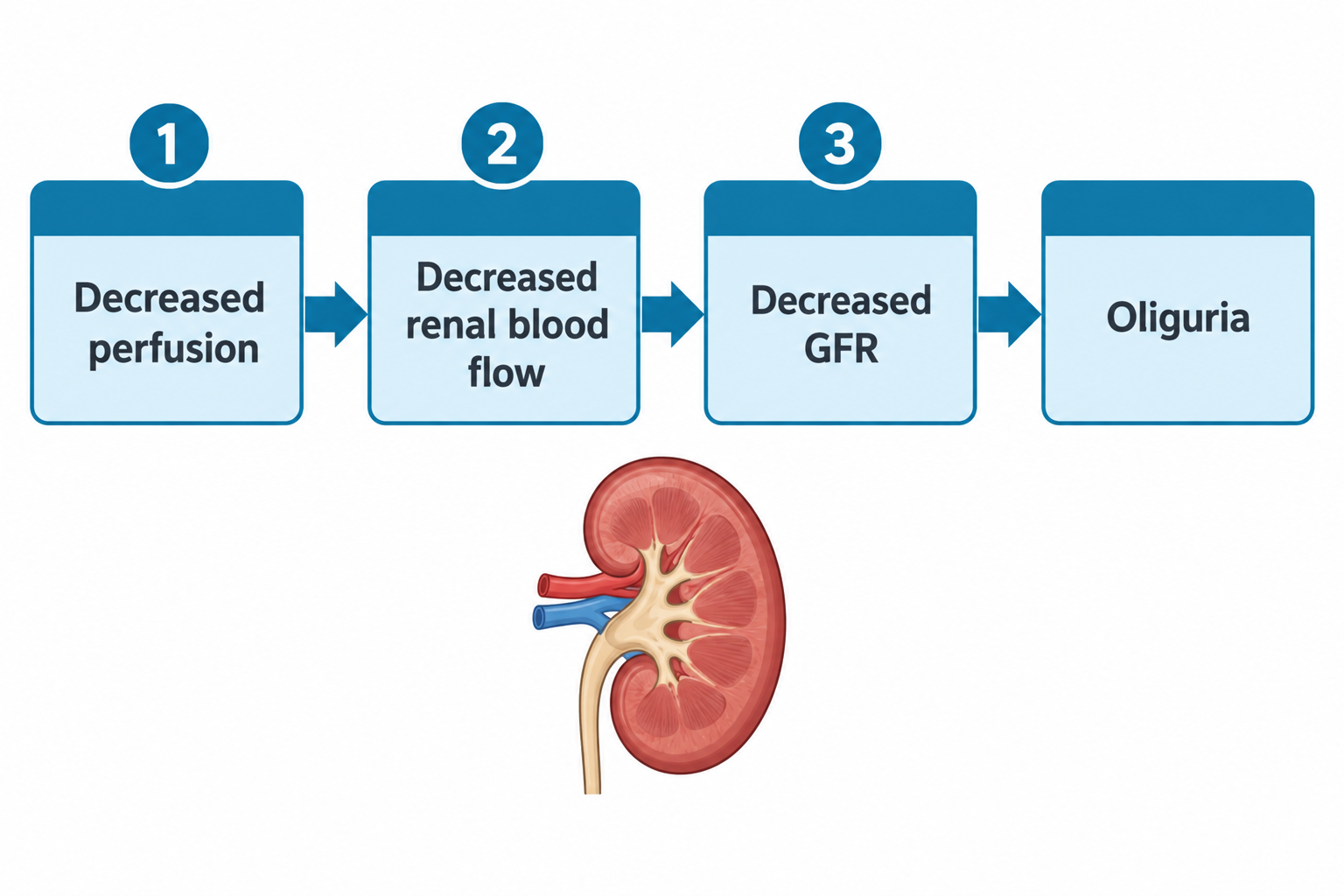 A four-step flowchart shows the pathophysiology of oliguria in shock: Decreased perfusion leads to decreased renal blood flow, which leads to decreased glomerular filtration rate (GFR), which leads to oliguria. Below the flowchart is a cross-sectional illustration of a kidney showing the renal artery (red) and renal vein (blue) entering at the hilum.