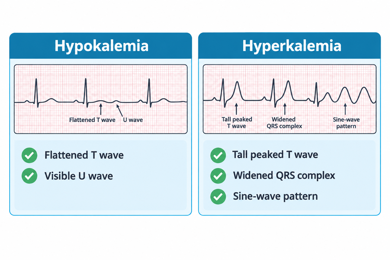 Two side-by-side ECG strips compare potassium imbalances. The hypokalemia strip shows a flattened T wave and a following U wave labeled with arrows, with checkmarked bullets for 'Flattened T wave' and 'Visible U wave'. The hyperkalemia strip shows a tall peaked T wave, a widened QRS complex, and a smooth sine-wave pattern labeled with arrows, with checkmarked bullets for 'Tall peaked T wave', 'Widened QRS complex', and 'Sine-wave pattern'.