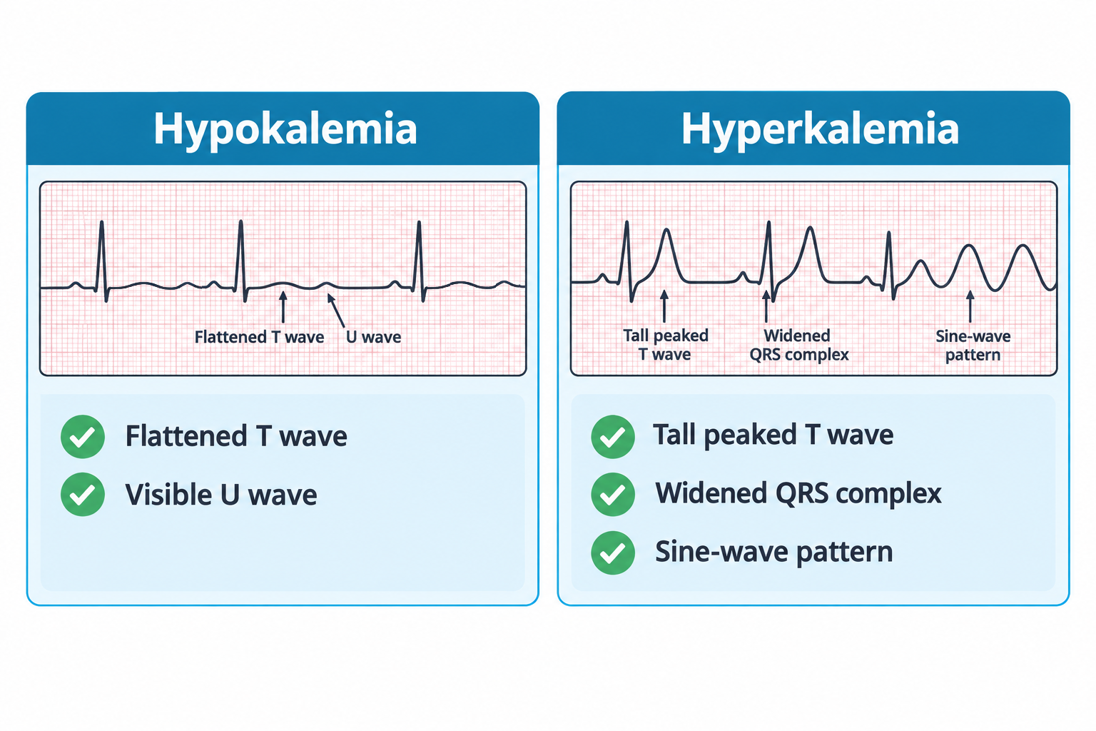 Two ECG strips compare potassium imbalances. The hypokalemia strip shows a flattened T wave followed by a small U wave, labeled with arrows. The hyperkalemia strip shows, in sequence, a tall peaked T wave, a widened QRS complex, and a smooth sine-wave pattern, each labeled with arrows.