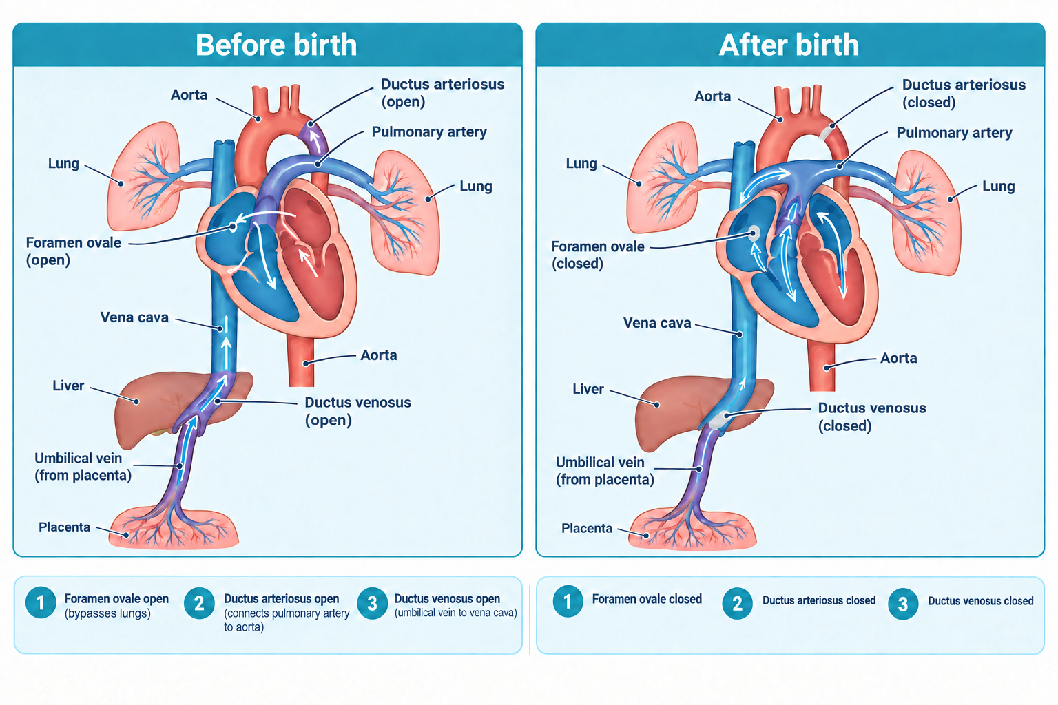 Side-by-side heart diagrams compare fetal and newborn circulation. The before-birth panel shows the foramen ovale, ductus arteriosus, and ductus venosus all open, with blood flow arrows bypassing the lungs and liver and umbilical vessels connecting to the placenta. The after-birth panel shows the same three structures closed, with blood now flowing through the lungs in the normal postnatal pattern and the umbilical vessels no longer connected to a placenta.