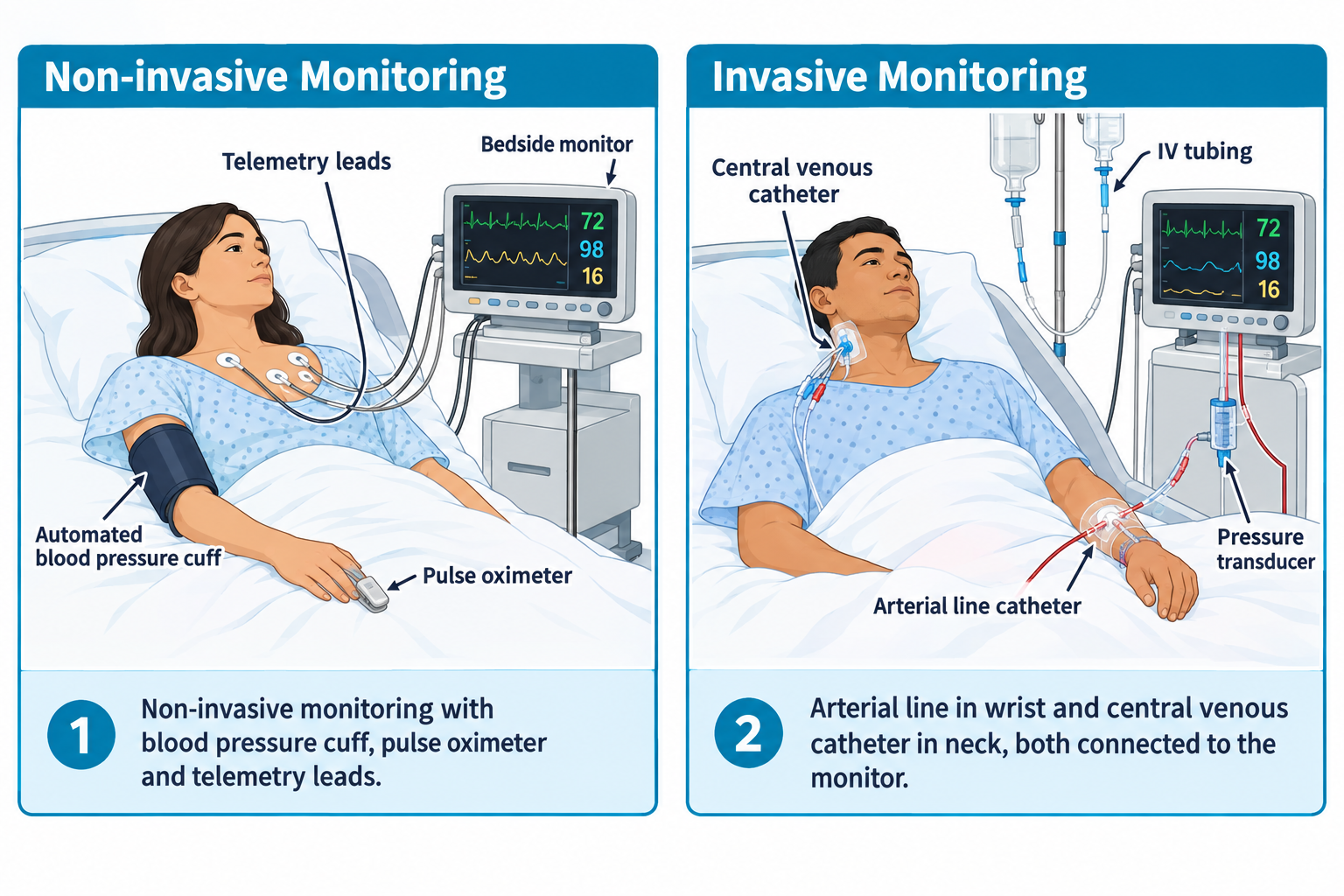 Two side-by-side hospital bed scenes. Left panel shows non-invasive monitoring: a woman in bed with ECG telemetry leads on her chest, an automated blood pressure cuff on her upper arm, a pulse oximeter clipped to her finger, all connected to a bedside monitor displaying heart rate, oxygen saturation, and respiratory rate. Right panel shows invasive monitoring: a man in bed with a central venous catheter inserted in his neck and an arterial line catheter in his wrist, both linked through IV tubing and a pressure transducer to a bedside monitor showing the same vital sign readout.