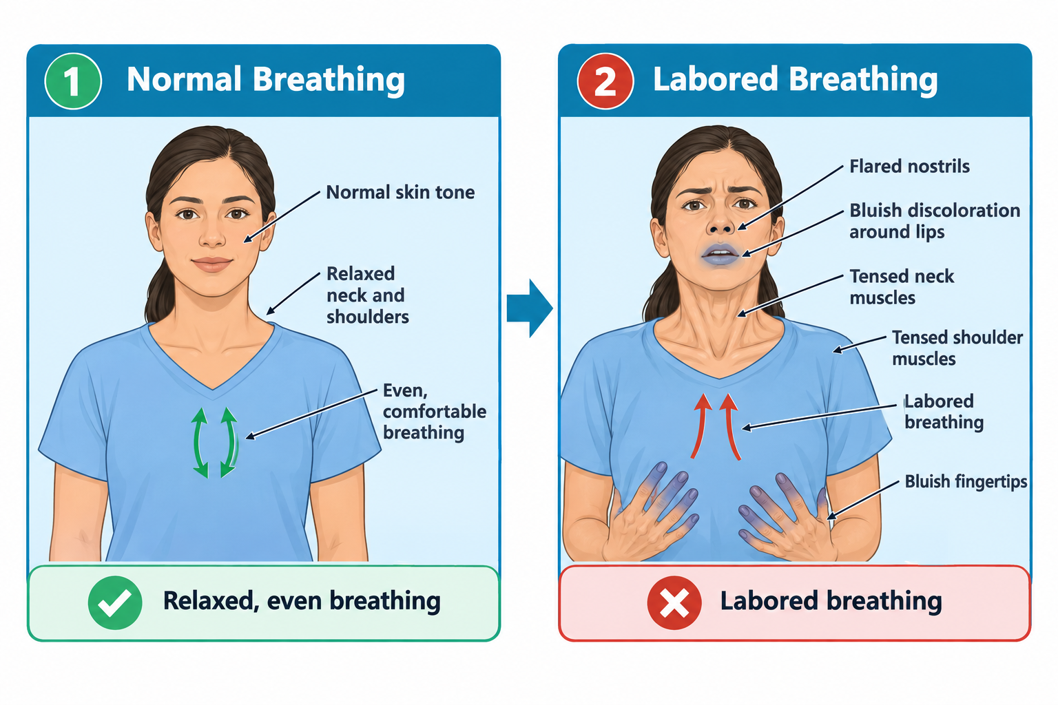 Two side-by-side upper-body illustrations of a woman compare normal and labored breathing. On the left, labeled Normal Breathing, she has relaxed neck and shoulders, normal skin tone, and even breathing indicated by symmetrical arrows over the chest. On the right, labeled Labored Breathing, she shows flared nostrils, bluish discoloration around the lips, tensed neck and shoulder muscles, upward arrows over the chest indicating labored breathing, and bluish fingertips as she holds her hands to her chest.