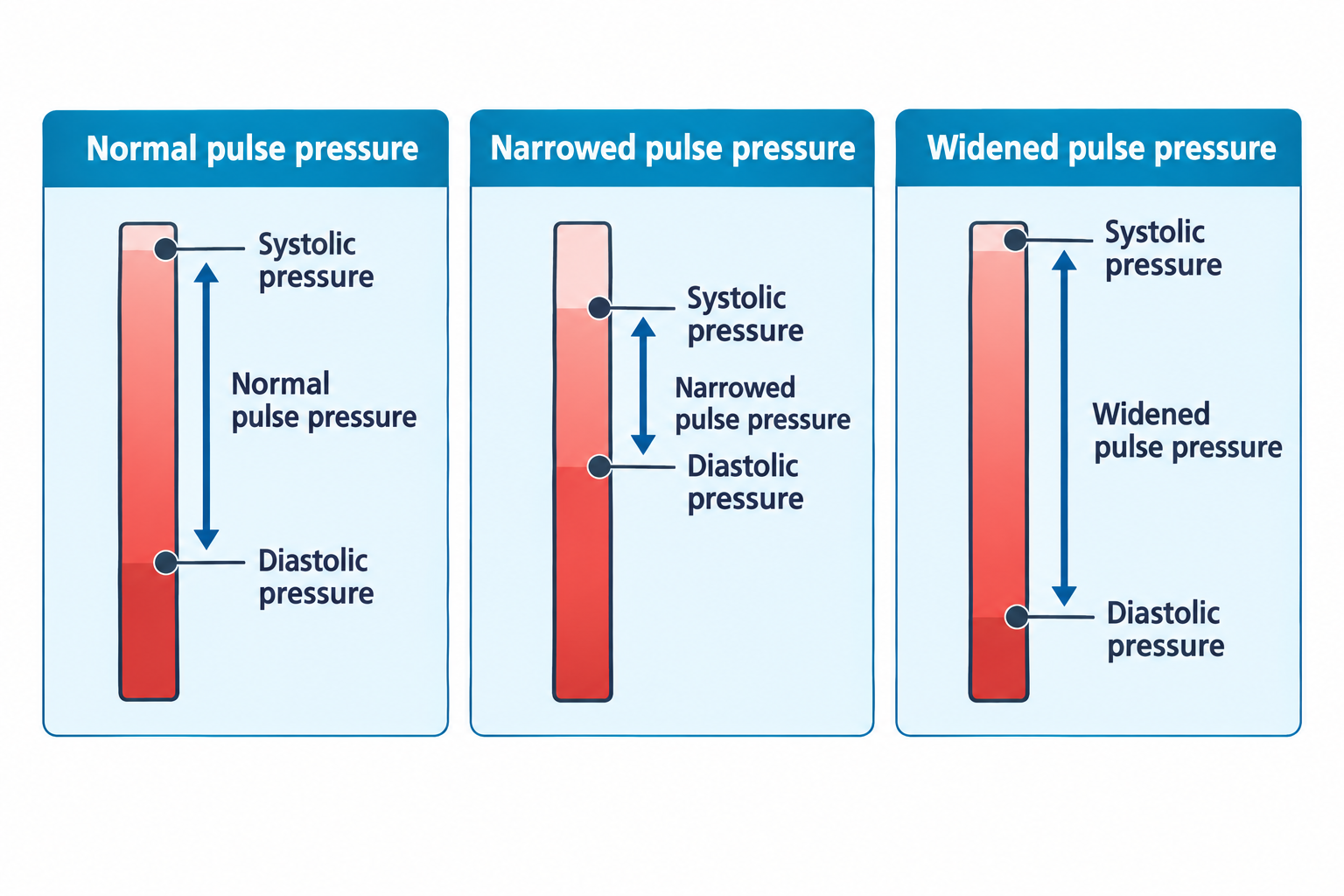 Three vertical pressure-gauge bars compare pulse pressure patterns: a normal bar with systolic and diastolic markers spaced at an average distance labeled 'Normal pulse pressure'; a narrowed bar with systolic and diastolic markers close together labeled 'Narrowed pulse pressure'; and a widened bar with systolic and diastolic markers far apart labeled 'Widened pulse pressure'.