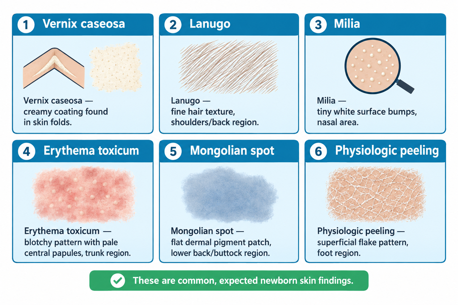 A six-panel grid of numbered newborn skin findings: (1) Vernix caseosa, a white creamy coating in a skin crease and as a close-up texture; (2) Lanugo, fine soft hair strands; (3) Milia, tiny white bumps on skin viewed through a magnifying glass; (4) Erythema toxicum, a blotchy red rash with small pale central bumps; (5) Mongolian spot, a flat blue-gray patch of skin; (6) Physiologic peeling, dry cracked and flaking skin texture. A green banner beneath states these are common, expected newborn skin findings.