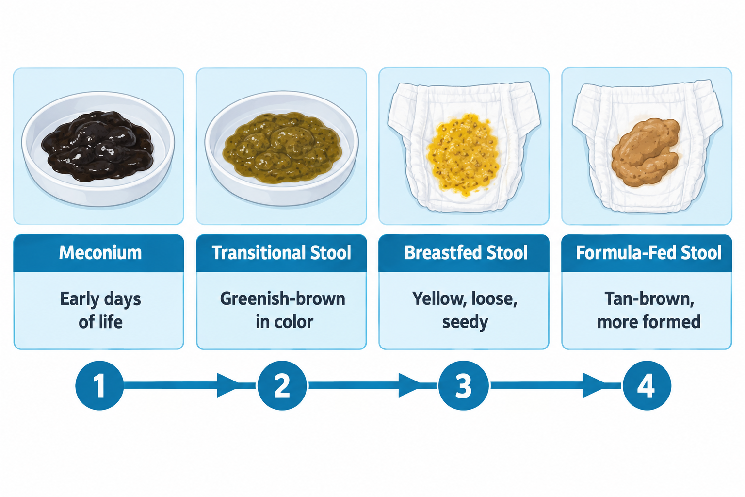 A four-step timeline of newborn stool changes: (1) dark, tarry meconium in a dish labeled 'early days of life'; (2) greenish-brown transitional stool in a dish; (3) yellow, loose, seedy breastfed stool on a diaper; (4) tan-brown, more formed formula-fed stool on a diaper, with numbered arrows connecting the stages in order.