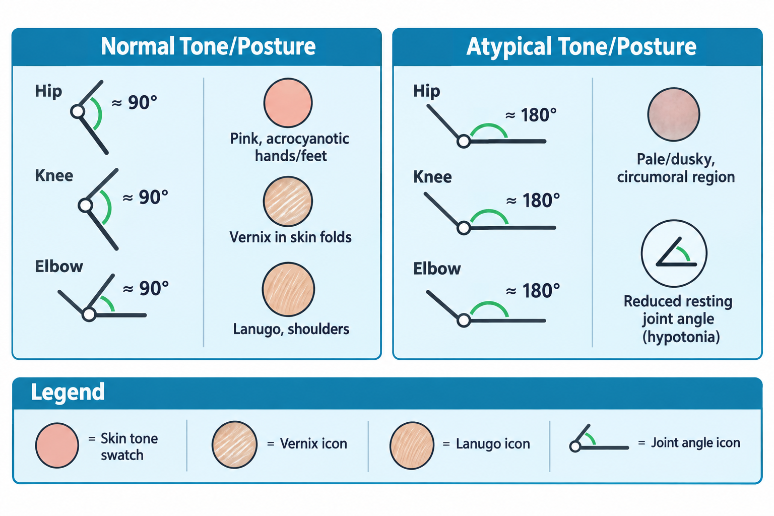A two-panel comparison of newborn tone and appearance: the normal panel shows the hip, knee, and elbow flexed at roughly 90 degrees, with skin tone swatches for pink coloring with acrocyanotic hands/feet, vernix in skin folds, and lanugo on the shoulders; the atypical panel shows the same joints extended to roughly 180 degrees (reduced resting joint angle indicating hypotonia) alongside a pale/dusky circumoral skin swatch. A legend at the bottom explains the skin tone, vernix, lanugo, and joint-angle icons.