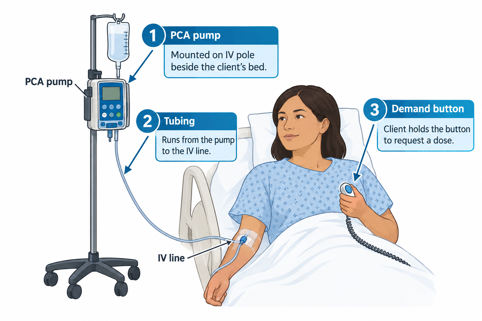 A young woman reclines in a hospital bed holding a PCA demand button in her hand, connected by coiled cord; her IV line is taped in her forearm and tubing runs up to a PCA pump mounted on an IV pole beside the bed, with a fluid bag hanging above the pump. Numbered callouts identify the PCA pump on the IV pole, the tubing connecting the pump to the IV line, and the demand button the client presses to request a dose.