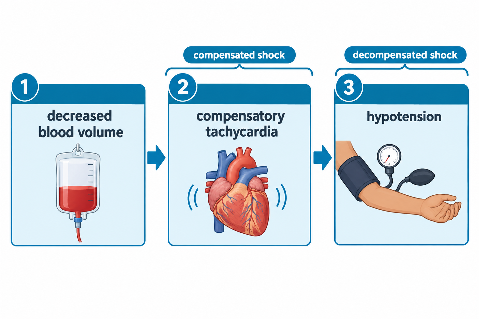 A three-step flow diagram shows shock progression: step 1, decreased blood volume depicted as a blood bag; step 2, compensatory tachycardia depicted as a pulsing heart, labeled as compensated shock; step 3, hypotension depicted as a blood pressure cuff being used on an arm, labeled as decompensated shock. Arrows connect the steps in sequence.