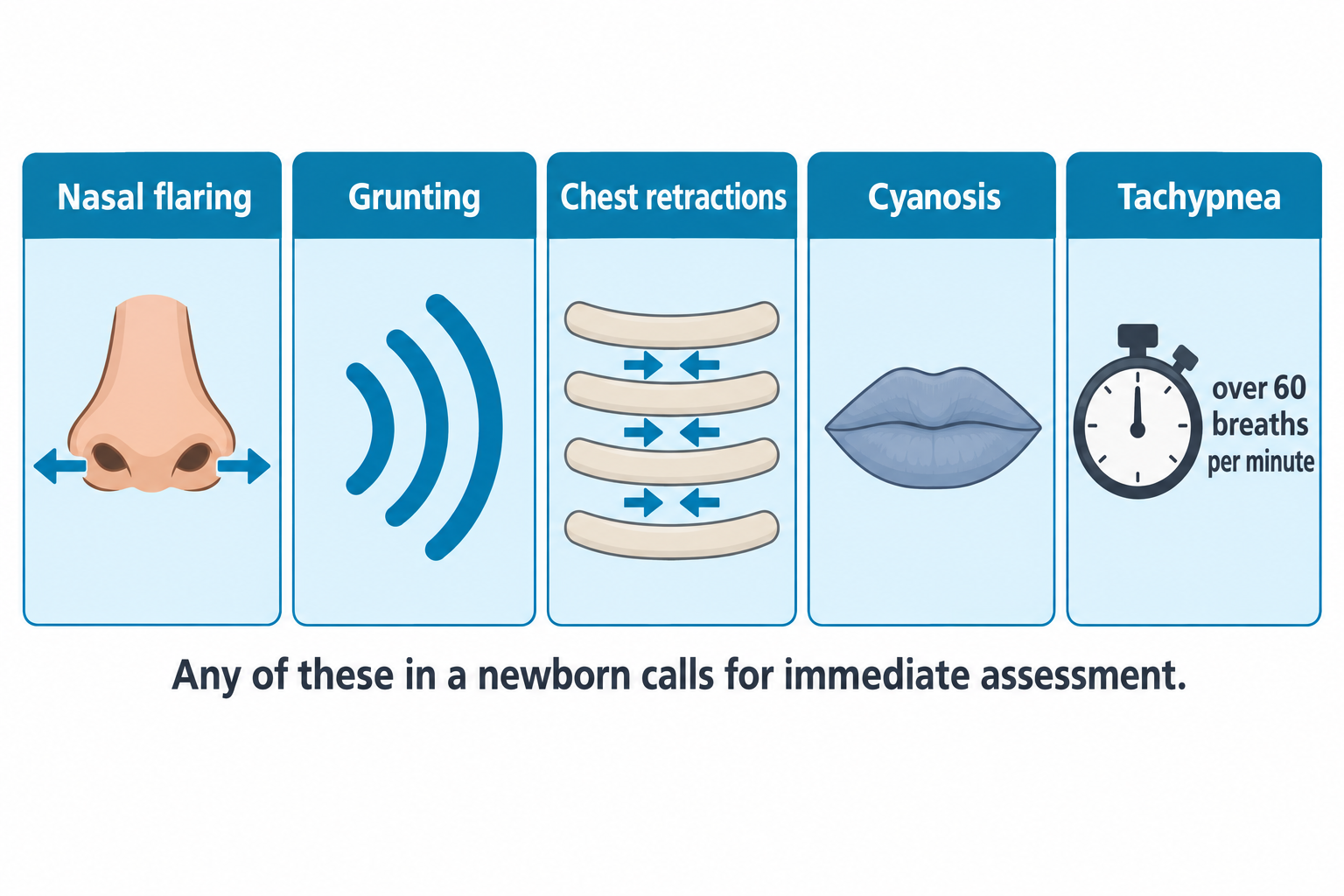 Five panels illustrating signs of newborn respiratory distress: a nose with arrows showing nasal flaring, sound waves representing grunting, a rib cage with inward arrows showing chest retractions, bluish lips indicating cyanosis, and a stopwatch labeled 'over 60 breaths per minute' representing tachypnea. Caption text reads: 'Any of these in a newborn calls for immediate assessment.'