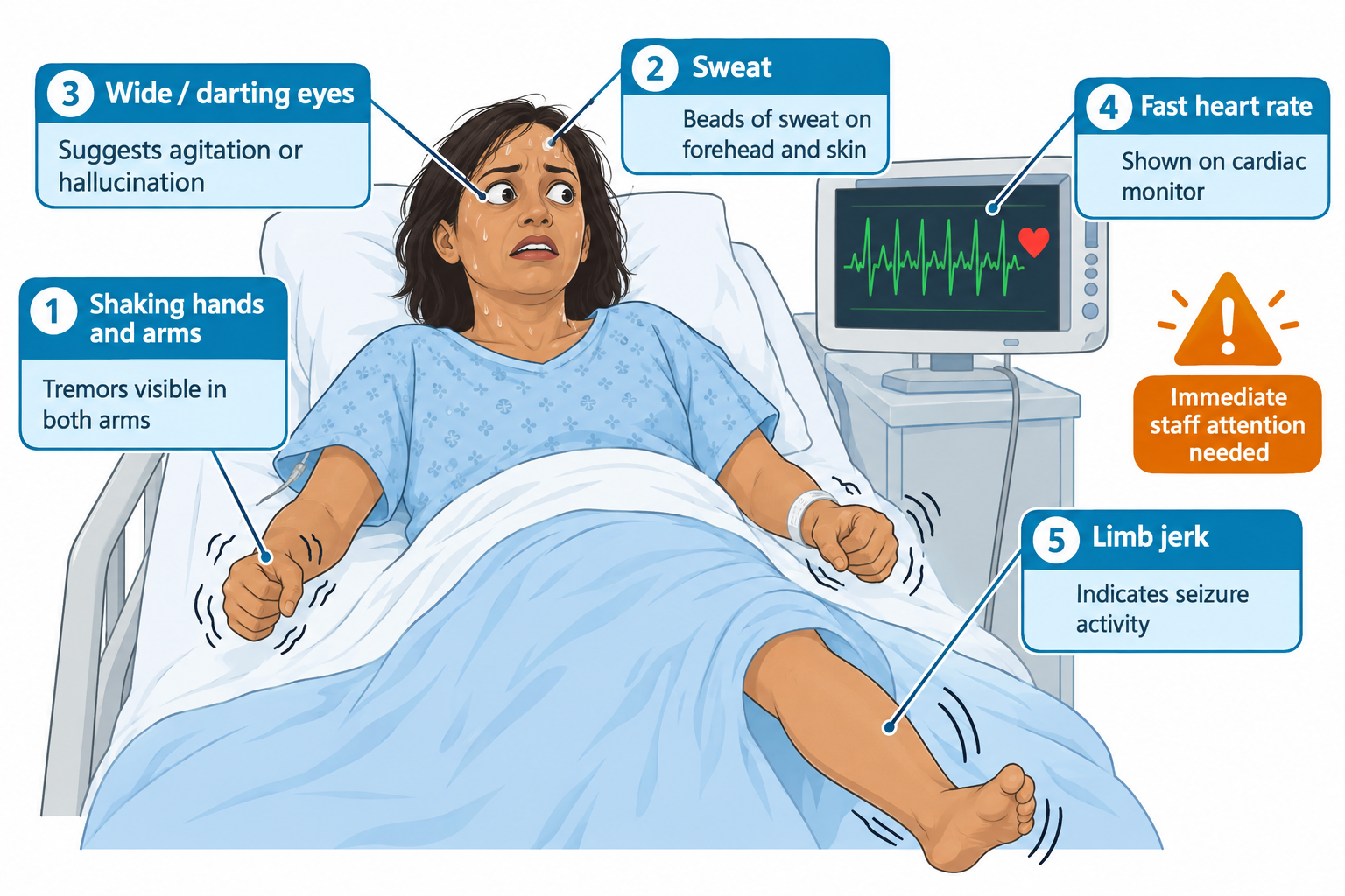 A distressed woman lies in a hospital bed wearing a gown, with an IV line in one arm. Numbered callouts point to visible tremors in both shaking hands, beads of sweat on her forehead, wide darting eyes suggesting agitation or hallucination, a cardiac monitor showing a fast heart rate, and a jerking leg indicating seizure activity. An orange banner reads 'Immediate staff attention needed.'