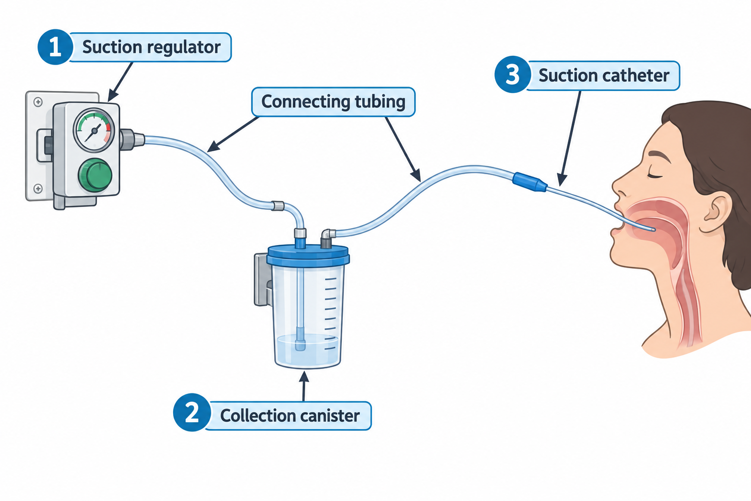 A suction setup diagram showing, from left to right, a wall-mounted suction regulator with pressure gauge and control knob (1), connected by tubing to a collection canister with fluid level markings (2), which connects via more tubing to a suction catheter (3) whose tip is inserted into the mouth of a person shown in profile, reaching toward the back of the oral cavity.
