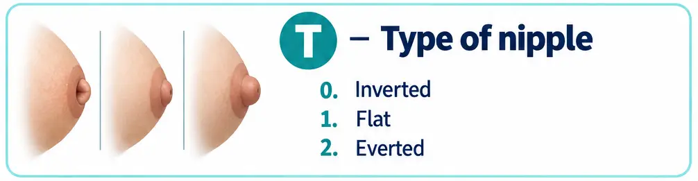 T for Type of nipple, scored 0 inverted, 1 flat, or 2 everted, illustrated with three breast images showing increasing nipple protrusion from left to right.