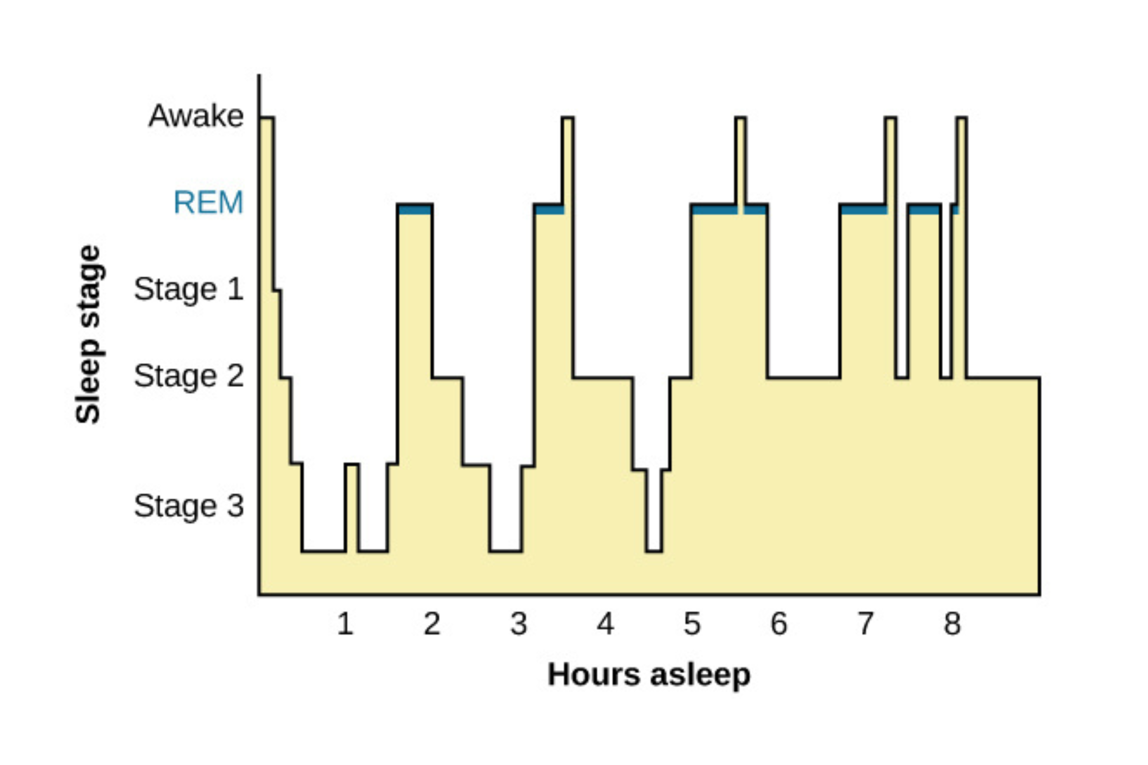Hypnogram showing sleep stages through a sleep cycle