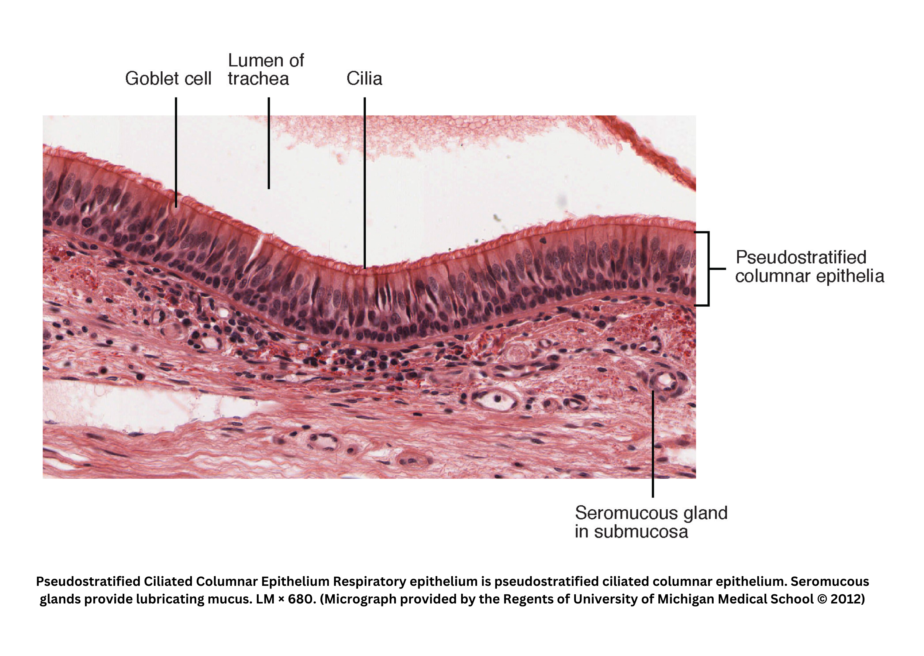 Pseudostratified ciliated columnar epithelium of respiratory tract with mucus glands