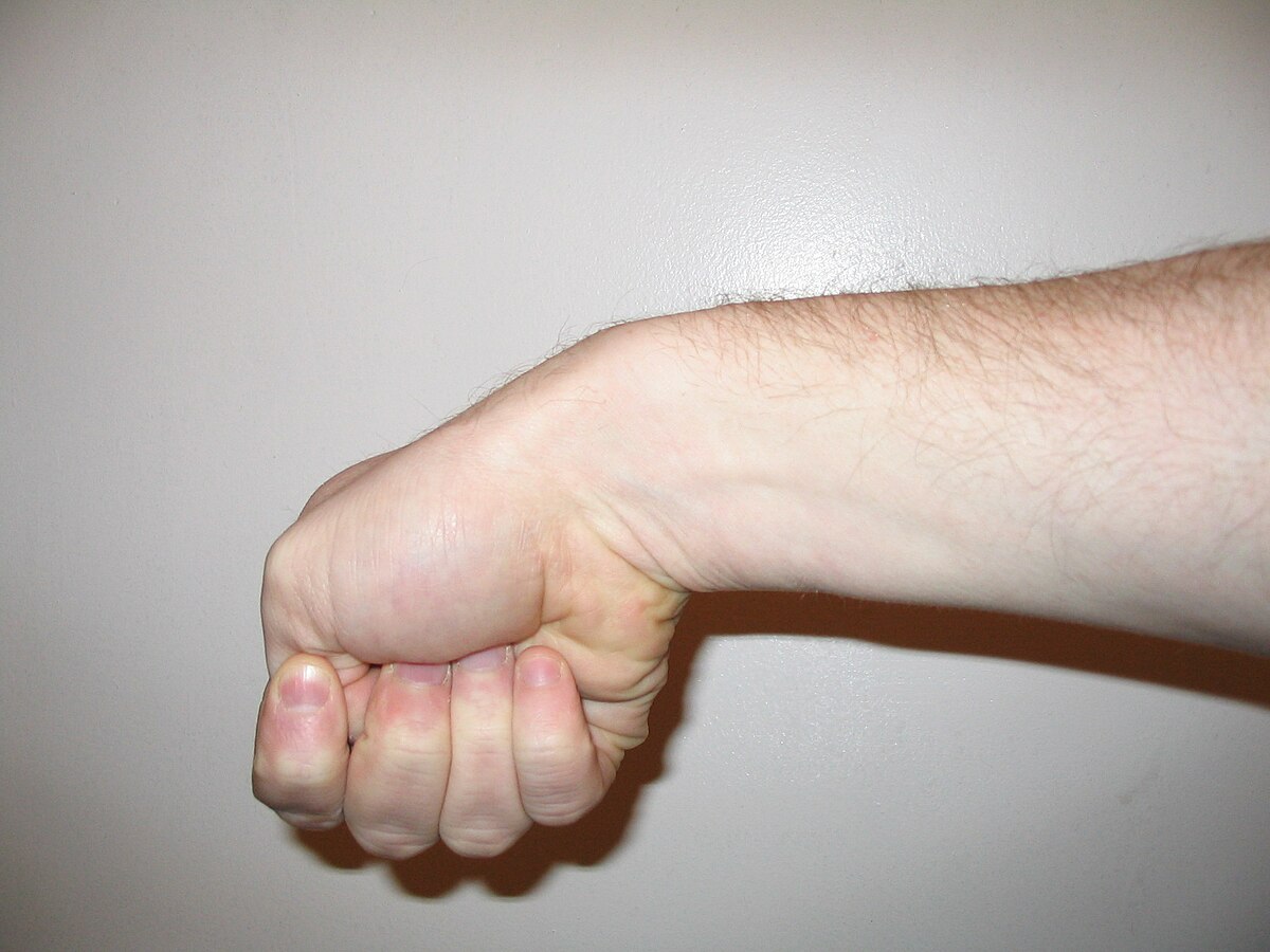 Eichhoff's test
