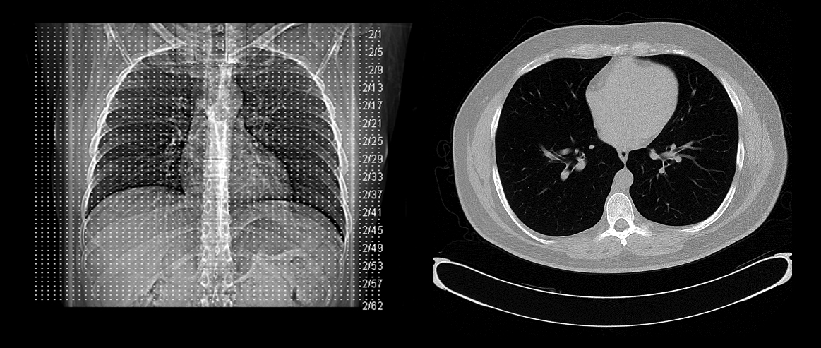 Examples of CT scan