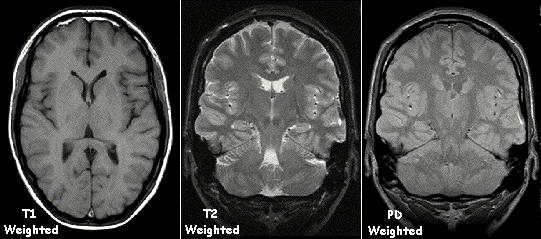 Examples of MRI