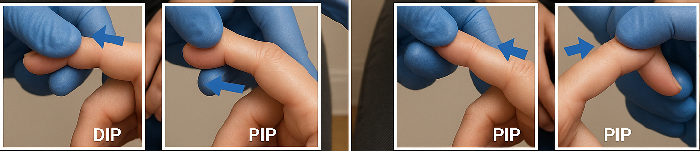  Interphalangeal joint varus/valgus tests