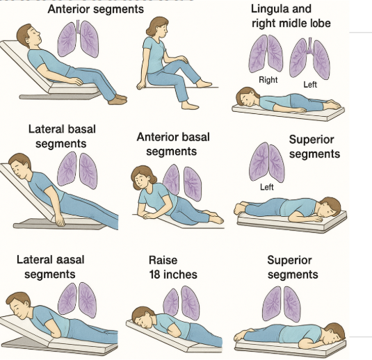 Postural drainage positions