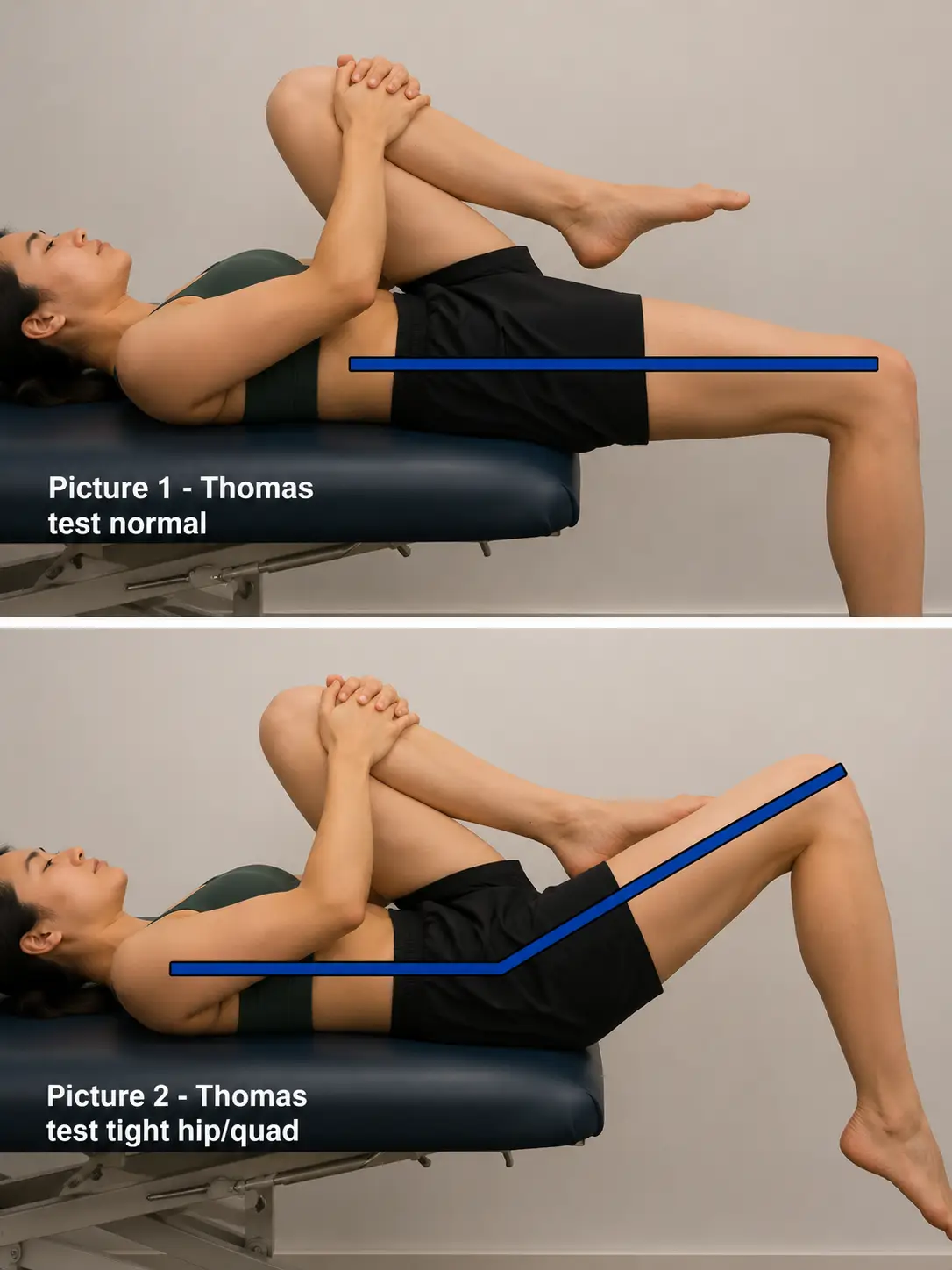 Thomas test assessing hip flexor tightness.