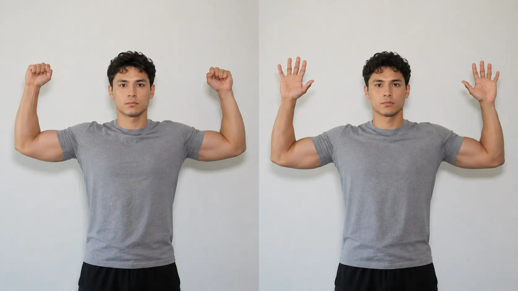 Roos test for thoracic outlet syndrome with both arms held in 90 degrees of shoulder abduction and external rotation while repeatedly opening and closing the hands.