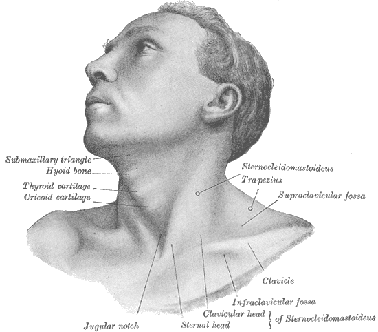 Torticollis