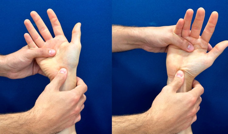 Watson (scaphoid shift)